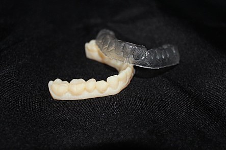 Fabricación de férulas de ortodoncia