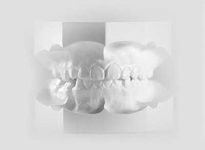 Creación de modelos de estudio de ortodoncia